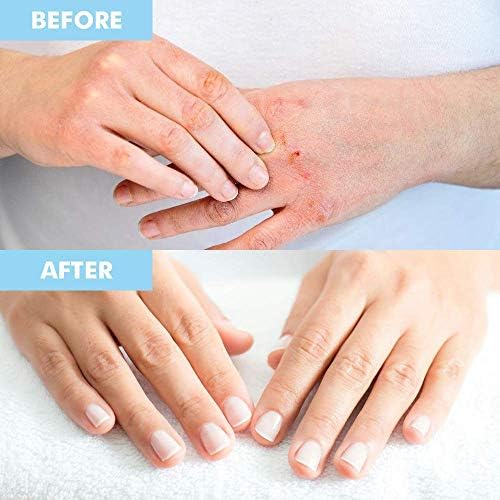 Bodipure Premium Hand and Foot Mask | Moisturizing Kertain Gloves & Socks | Hydrating Dull Dry Hands, Cracked Heels, Callus Softening & Nail Strengthening | Chemical-Free Feet Treatment | (6+6 Pack)