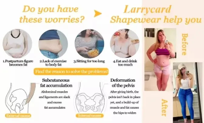 Seamless Shaped Up Tummy Control Shapewear with Bra BBL Bodysuits Invisible Front Breasted Modeling Fajas for Oversized Ladies