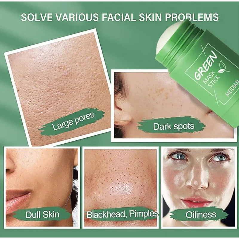 Original Facial Remove Blackhead Green Tea Solid Mask Treat Acne Blemish Black Dots Clean Stick Cream Shrink Pores Skin Care