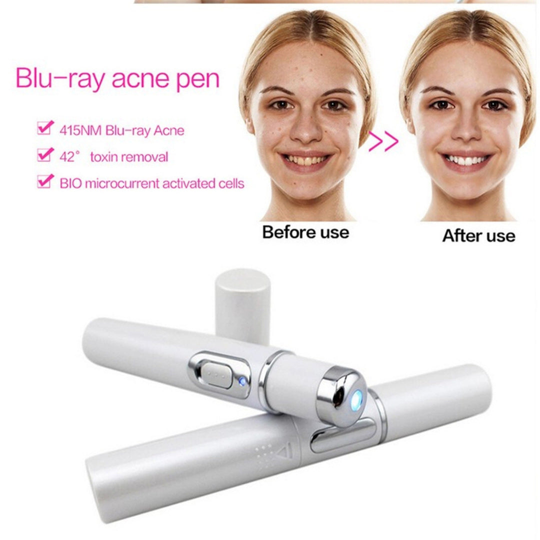 Blue Light Therapy Acne Pen