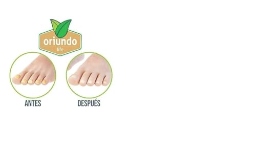 Oriundo Natural Life Nail Treatment Solution, 9 Ingredients, 3 Month Supply
