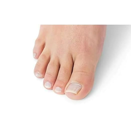 Oriundo Natural Treatment for Nails./ Natural producto para unas., 0.5 Fl Oz (Pack of 1), clear