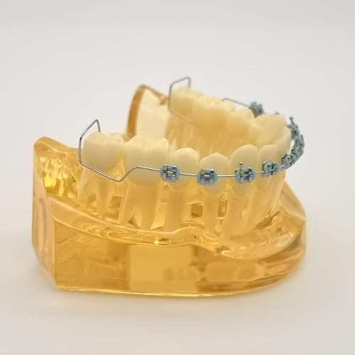 2 Pcs Temporary Tooth Decoration with Metal Wires Bracket Orthodontic Ligature Ties, Fashionable Colorful Fake Braces for Orthodontists Help Patients Understand Their Treatment (Blue)