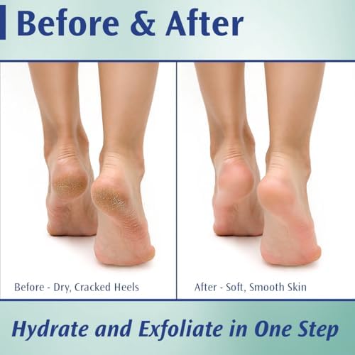 Pedifix Podiatrists' Choice 20% Urea Callus Control Extra Strength Foot Cream 4 Oz. (113g) - Professional Treatment for Dry, Cracked Feet, Callus & Foot Care Relief