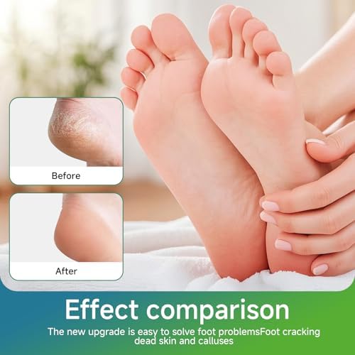 2Pcs Nano Glass Foot File,Nano-Glass Foot File,Foot Scraper for Callus Removal,Veinsgrain Foot Files (Gold+Blue)