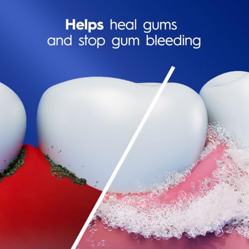 Crest Pro-Health Gum Detoxify Deep Clean Toothpaste 4.8 oz - Anticavity, Antibacterial Flouride Toothpaste, Clinically Proven, Gum and Enamel Protection, Plaque Control