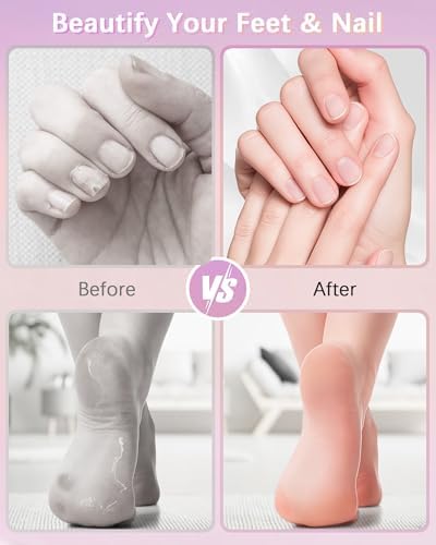 2 in 1 Electric Foot Callus Remover, 9 Adjustable Speeds Foot Scrubber USB Rechargeable Pedicure Tools for Feet, Dry Dead Skin Scraper Foot Grinder with 80/120 Grit Sandpaper Discs Rollers for Women