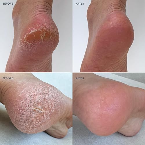 VOESH Solemate Heel Repair Balm, Moisturizer, Heel Repair, Balm for Rough & Cracked Heels, Foot Care - Lavender