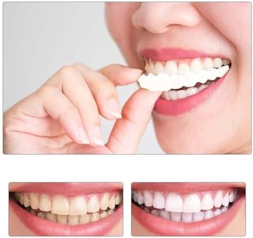 2 Pairs, Temporarily Adjustable for Men and Women, Regain Confidence Smile