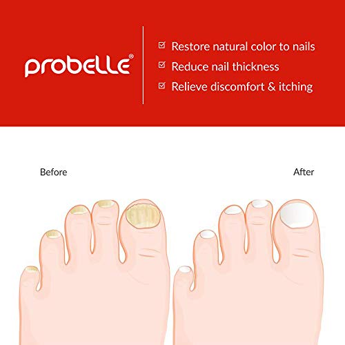 Probelle Natural Fungal Nail Oil, Nail Color Restoration, Clear Topical Solution .5 oz/ 15 ml