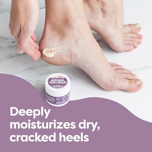 ZenToes Natural Foot Balm | Hydrating Cream for Dry, Cracked Heels & Feet | Enriched with Coconut, Tea Tree, Jojoba & Vitamin E Oils | Soothes & Softens Rough Skin | 2oz