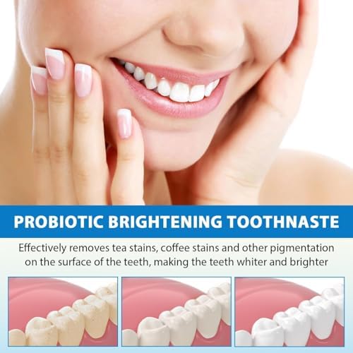 2PCS Sp 6 Probiotic Toothpaste Whitening Sp-6 Probiotics Whitening Toothpaste Fresh Flavor and Gum Health