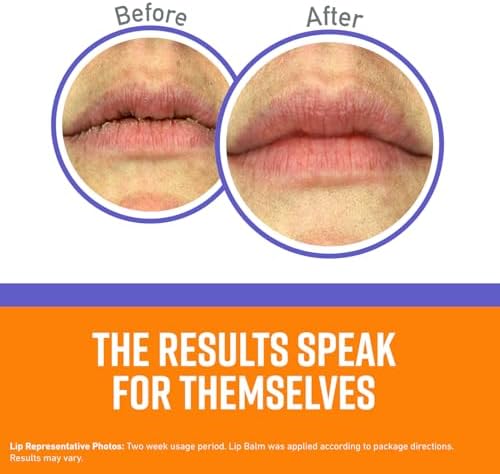 O'Keeffe's Night Treatment Combo Pack Including Working Hands Night Treatment Hand Cream, Healthy Feet Night Treatment Foot Cream and Lip Repair Night Treatment Lip Balm; Gift Idea