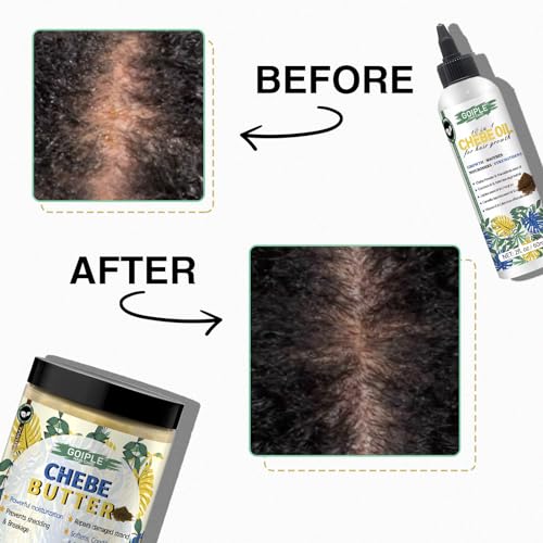 Chebe Hair Growth Oil and Butter for Deep Moisturization - All Hair Types, Men and Women