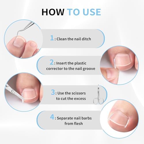 Ingrown Toenail Removal Kit Includes Ingrown Toenail Corrector, Tweezer, 50pcs Nail Patches,12 Nail Retainer,10 Toenail Corrector Strips