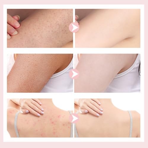 Super Soft Sunflower Suction Cup Bath Ball, 2025 New Bath Cleaning Brush, 2-in-1 Sponge Mesh Pouf Ball Body Scrubber, Shower Gloves Exfoliating Accessories for Men and Women