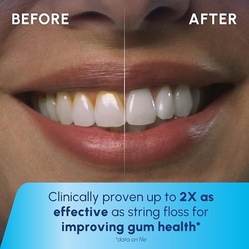 Waterpik Cordless 1100 Rechargeable Portable Water Flosser for Teeth Cleaning and Flossing, Travel, Braces Care, Healthier Gums, Waterproof for Shower, ADA Accepted, WF-30CD White, Packaging May Vary