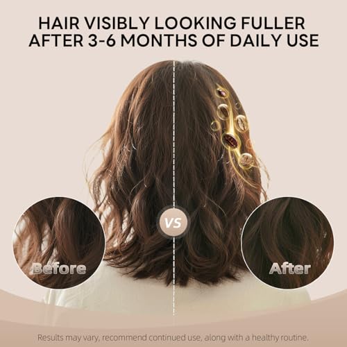 Caffeine Shampoo and Conditioner Set | Strengthens Hair & Supports Scalp Health | Biotin & Niacinamide for Thicker, Fuller Hair | Sulfate-Free for Oily Scalp & Thinning Hair | 10.7 oz Each