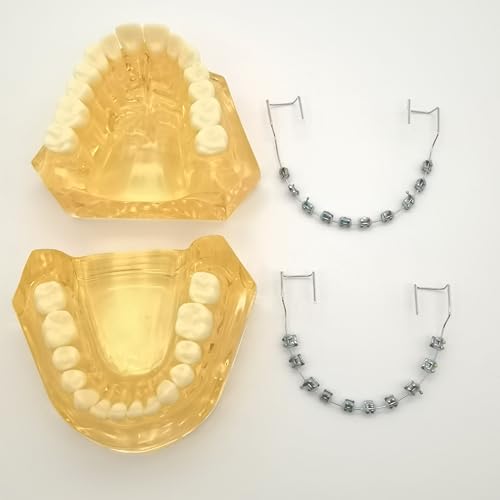 2 Pcs Temporary Tooth Decoration with Metal Wires Bracket Orthodontic Ligature Ties, Fashionable Colorful Fake Braces for Orthodontists Help Patients Understand Their Treatment (Blue)