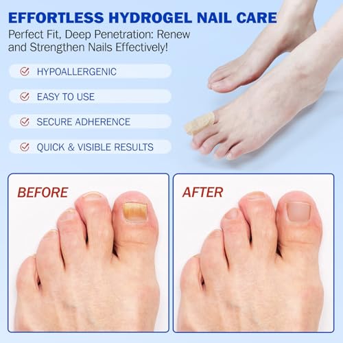 Nail Patches For Toenails & Fingernails – 21Pcs Nail Repair Stickers For Damaged Nails, Ingrown & Discoloration Care, Random (2 pack)