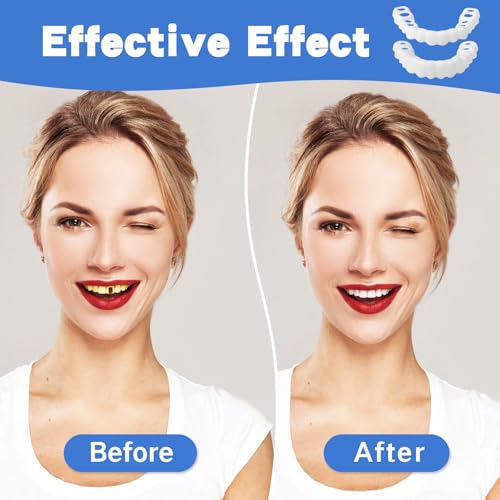 3 Pairs Fake Dentures Temporary Denture Teeth Snap-On Top and Bottom Teeth Covers for Men and Women Instant Confidence Smile Fix Easy-to-Use Fake Teeth for Missing or Broken