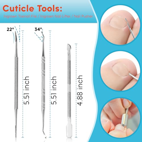 Ingrown Toenail Kit, Ginger Ingrown Toenail Treatment, Drops with Tools for Big Toe Ingrown Pain Relief, Toenail Clippers For Thick & Ingrown Nails, Ingrown Toenail Removal Kit