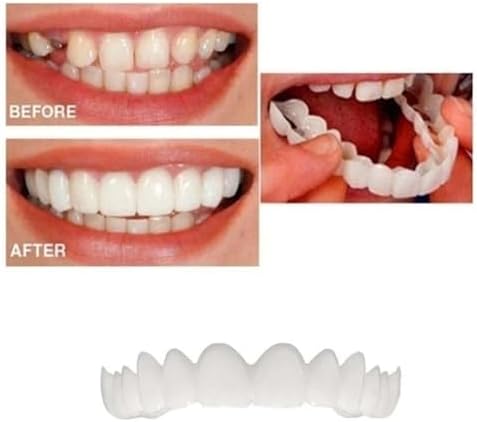 2 Pairs, Temporarily Adjustable for Men and Women, Regain Confidence Smile