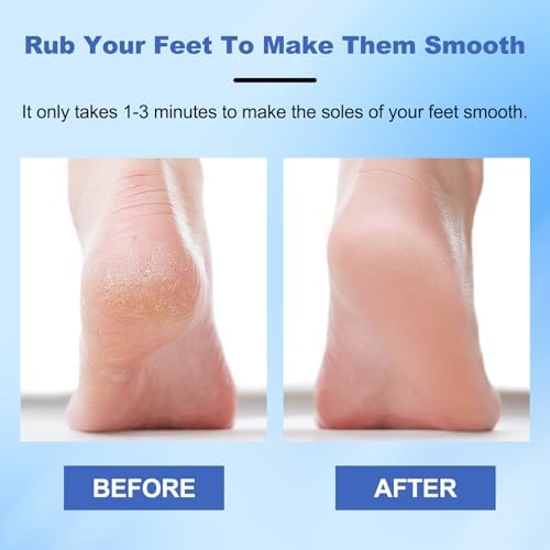 2PCS Veinsgrain Veins Grain Foot File, Professional Foot Care Tools, Nano Glass Foot File with Non-Slip Ergonomic Handle Feet Massage Tool (Gold+Blue)