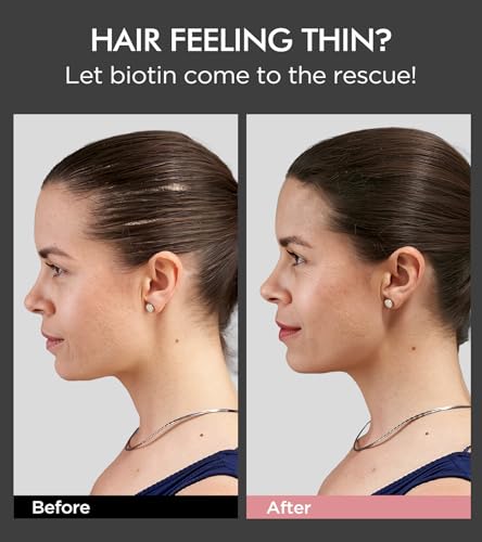 Tripeptide-Infused Hair Growth Biotin Shampoo and Conditioner Set, Onion Anti-Loss Volumizing Moisturizing Treatment for Soft Shine Hair, Rosemary Clarifying Dandruff Shampoo for Women Men, 2 x 16.9oz