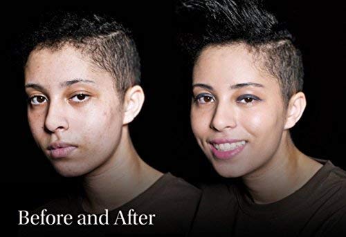 Keromask Full Coverage Concealer | Medium No 7 | Camouflage Makeup | Waterproof Concealer | Hypoallergenic | Vitiligo, Tattoo, Rosacea, Tattoo Cover |24 Shades