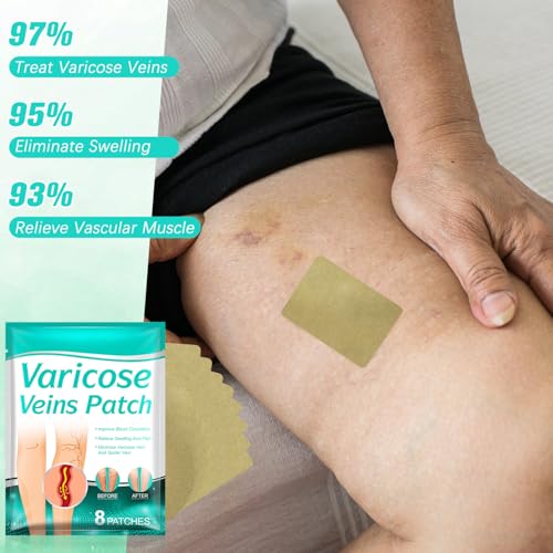 16Pcs LegRenew Varicose Veins Patch, Professional Varicose Veins Patch for Legs, Improves the Appearanceof Leg (2 Packs)
