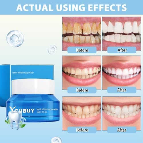 Teeth Whitening Powder, Teeth Whitening Toothpaste,White Tooth Powder,Instant,Stain Removal & Fresh Breath (2)