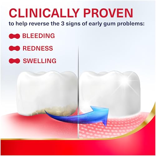 Parodontax Active Gum Repair Toothpaste, Toothpaste To Help Reverse Signs Of Early Disease For Health, Fresh Mint Flavored - 3.4 Oz x 3