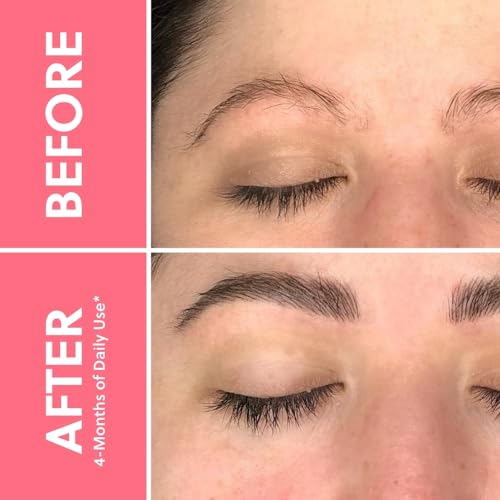 ForBrow Eyebrow Growth Serum For Thicker Brows - Natural & Organic Conditioner For Fuller and Thick Eyebrows | Vegan & Cruelty-Free Formula | New Innovative Peptides - [0.10 fl. oz/ 3ml]