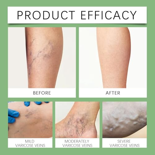 Miracle Balm Leg, Hand Skin Care Honey Balm, 3 Packs Soothing and Moisturizing Cream, Natural Ingredients, Simpler Moisturizing Solution (3 Packs)