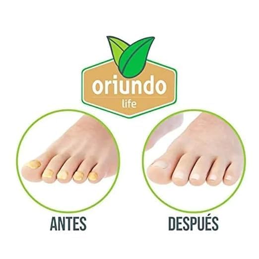 Oriundo Natural Treatment for Nails./ Natural producto para unas., 0.5 Fl Oz (Pack of 1), clear