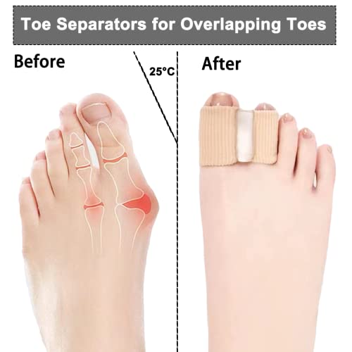 12 Packs Gel Toe Separators for Overlapping Toes, Toe Spacers for Bunions Bunion Corrector for Women and Men, 2 Loops Bunion Corrector for First Two Toes