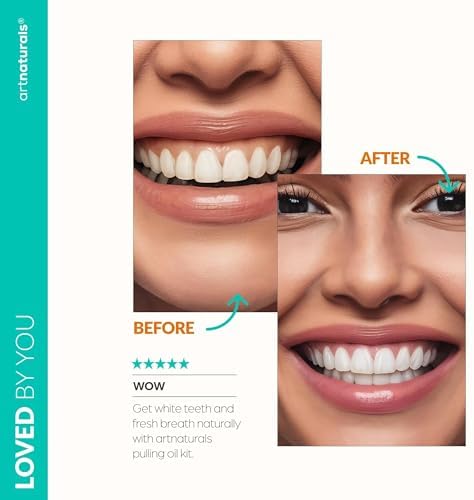 artnaturals Coconut Oil Pulling (8oz) Tongue Scraper & Toothbrush Set - Alcohol-Free Mouthwash - Infused with Magnesium & Peppermint for Teeth Whitening & Fresh, Healthy Breath and Gums