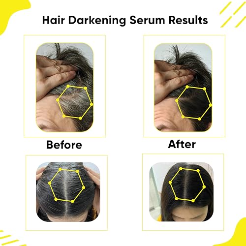 Anti Gray Hair Darkening Serum | Reverses & Limits Hair & Beard Graying with Arcolys, Melano Gray, for Promoting Darker, Shinier Hair and Beard, For Both Men & Women, 1.01 fl.oz./30 ml