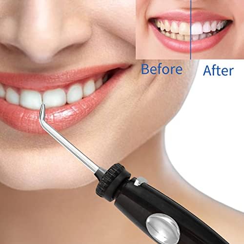 Oral Hygiene Accessories Black Handle Hose Replacement for Waterpik WP-100 WP-130 WP-140W WP-270W WP-660 WP-660C WP-900 Series Water Flosser