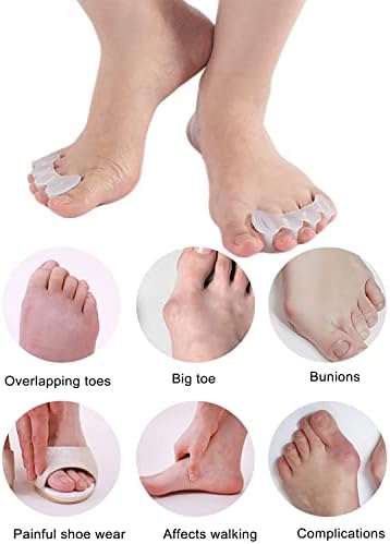 2Pairs Toe Separators Toe Spacers for Women Men to Correct Bunion, Relieve Feet Pain, Foot Alignment, Toe Straighteners for Hammertoes, Plantar Fasciitis (M, Women Shoe Size 9-12.5, Men: 7-11)
