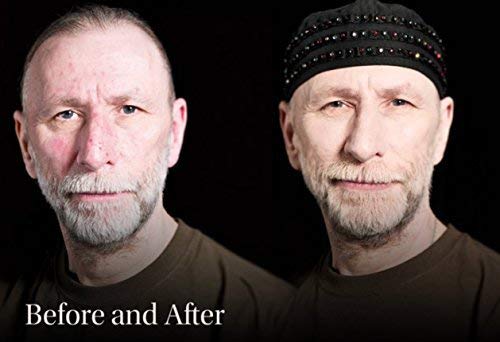 Keromask Full Coverage Concealer | Medium No 7 | Camouflage Makeup | Waterproof Concealer | Hypoallergenic | Vitiligo, Tattoo, Rosacea, Tattoo Cover |24 Shades