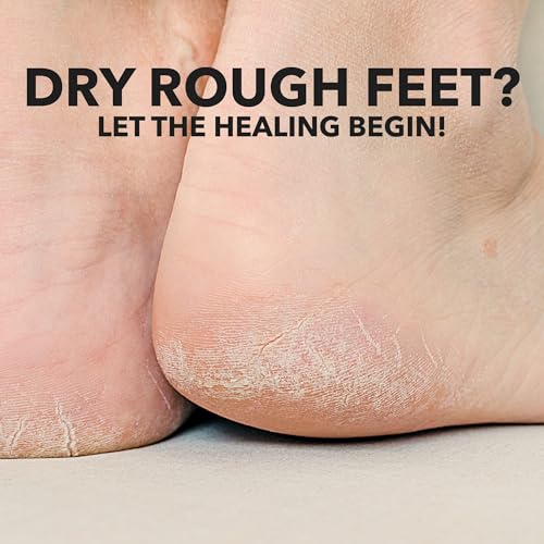 Adamia Therapeutic Repair Foot Cream with Macadamia Nut Oil and Promega-7, 4 Ounce Tube - Fragrance Free, Paraben Free, Non GMO