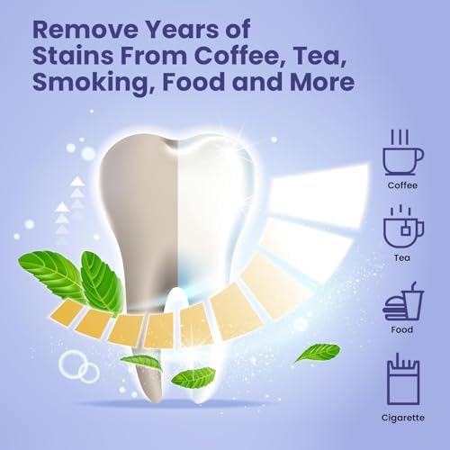 Teeth Whitening Strips, 7/14 Day Treatments, White Strips for Teeth Whitening, Residue-Free, Enamel Safe, Intensive Whitening, Rinse-Free (14 Count)