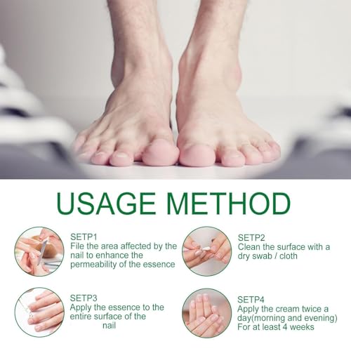 7 days Nail Growth Serum, 2PCS 7 Days Ginger Nail Essence, Multi-Purpose Nail Repair, Nail Nutrient Oil Strengthener Oil (2pcs)