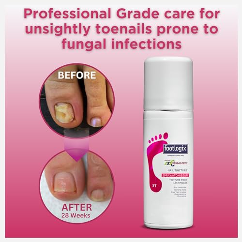 FOOTLOGIX Nail Tincture Spray with Spiraleen, 1.69 Fl Oz (Pack of 1)