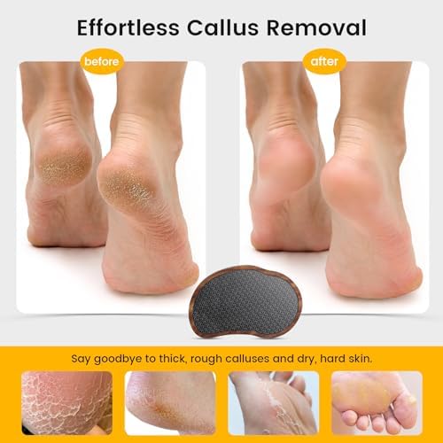 BEZOX Glass Foot Scrubber(1 PCS) - Nano-Glass Pedi Egg Pumice Stone for Feet Dead Skin, Plastic-Free Pedicure Foot File Callus Remover for Silky Smooth Feet - Walnut Wood Handled
