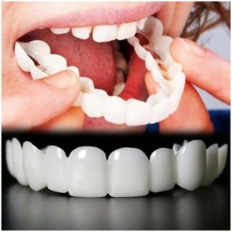 2 Pairs, Temporarily Adjustable for Men and Women, Regain Confidence Smile(Red)