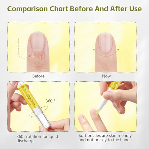 Rejuvenation Nail Growth Oil, Nail Oil for Growth and Strength Rejuvenation, Rejuvenation Nail Growth Serum for Nail Strengthener and Growth with Nails File (4PCS)