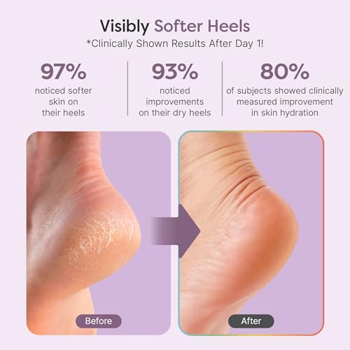 ZenToes Natural Foot Balm | Hydrating Cream for Dry, Cracked Heels & Feet | Enriched with Coconut, Tea Tree, Jojoba & Vitamin E Oils | Soothes & Softens Rough Skin | 2oz